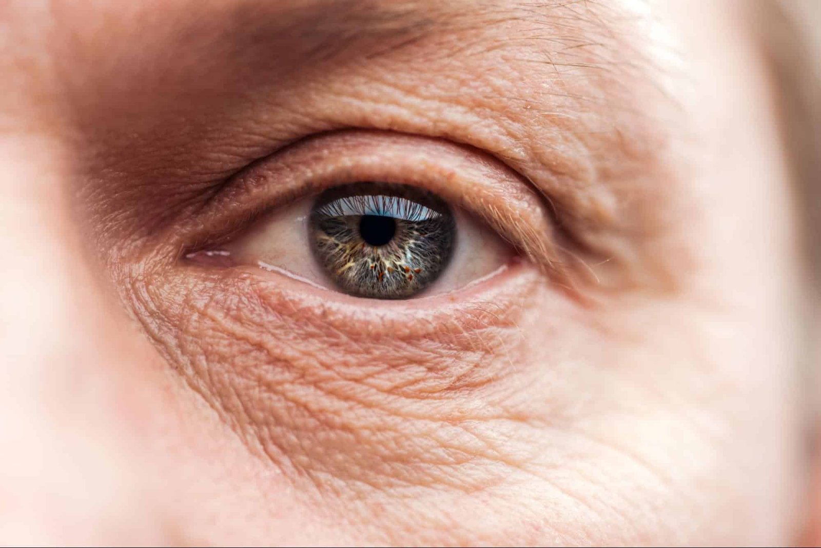 man with wrinkles around his eye