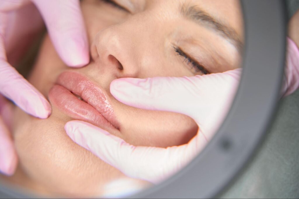 woman’s lips being examined, representing the curiosity behind the question “How long do dermal fillers last?”