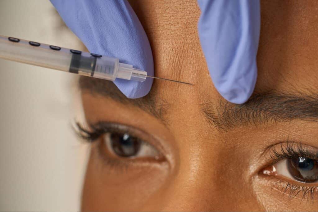 how many units of Botox do I need? Woman receiving facial injection