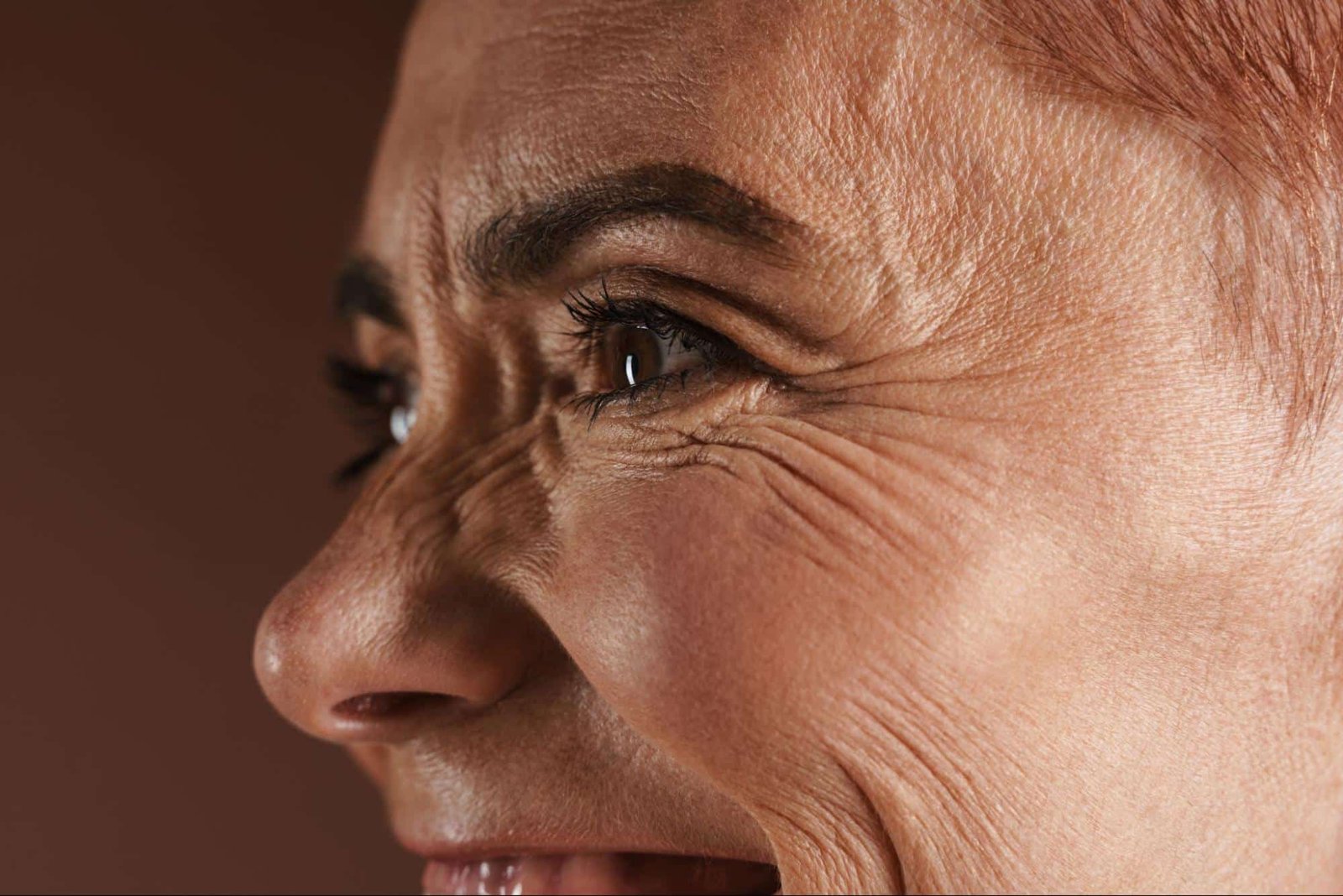 woman with facial wrinkles