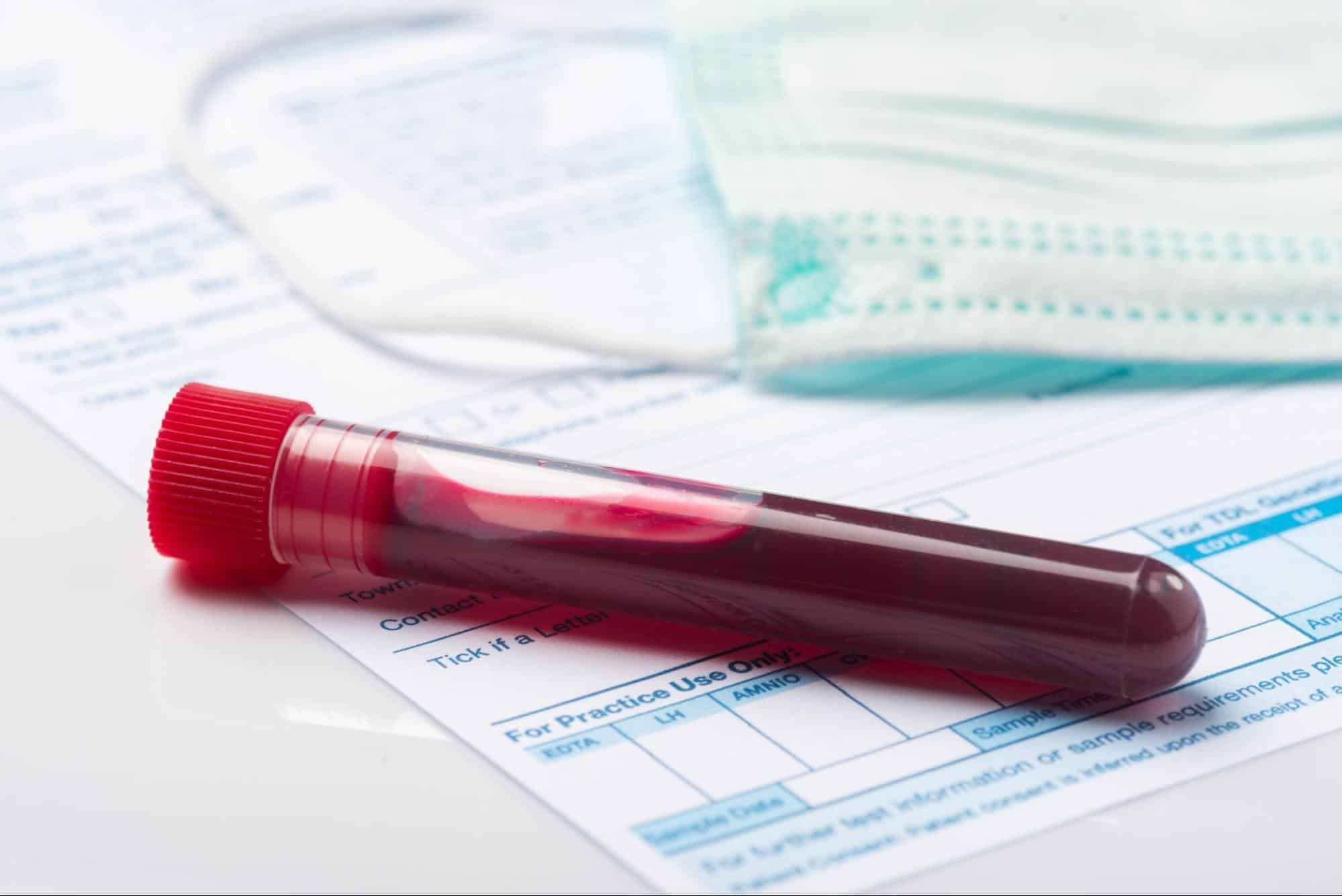 Blood sample tube on a lab form for routine testing at a preventive care clinic in Weslaco, TX.