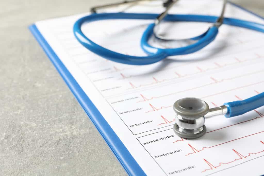 stethoscope and ECG exam results representing an annual physical exam in Weslaco