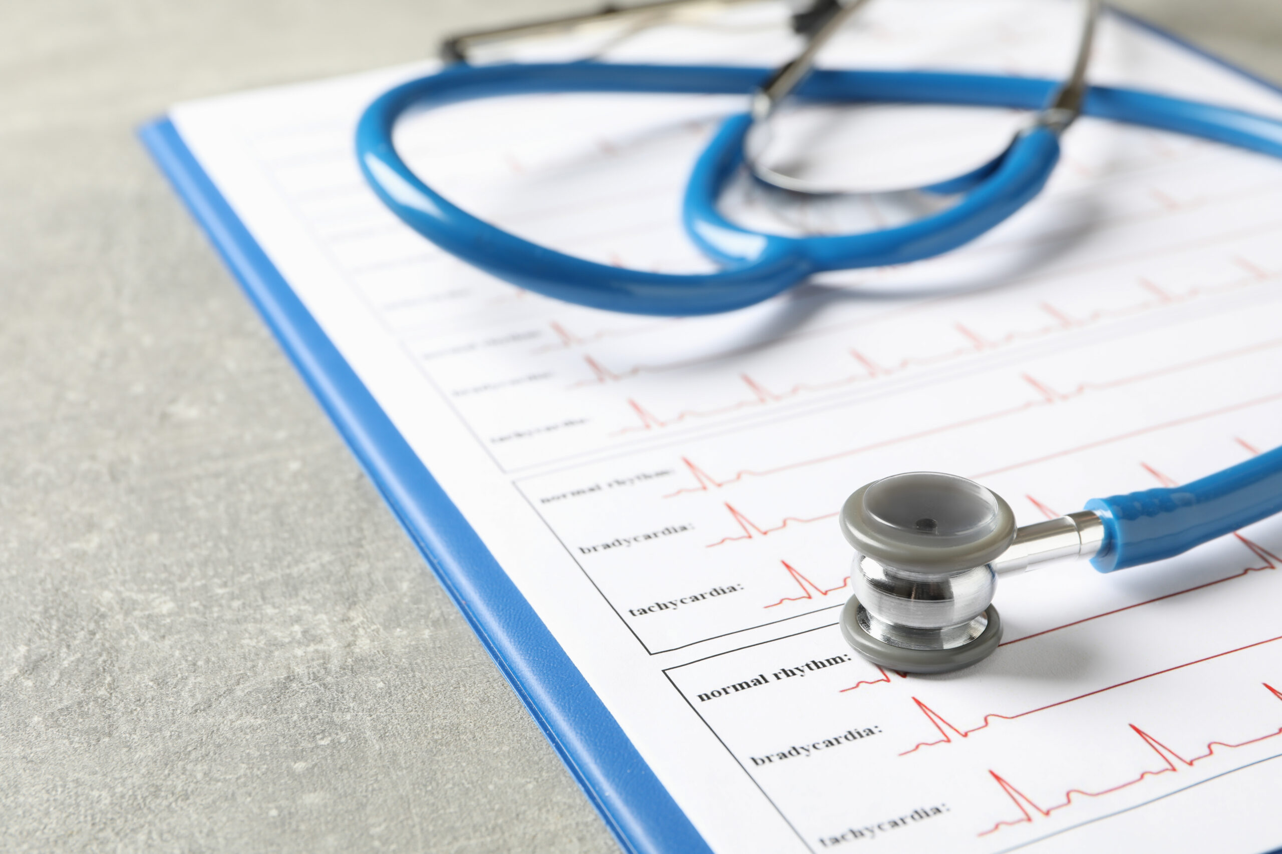 stethoscope on ECG results